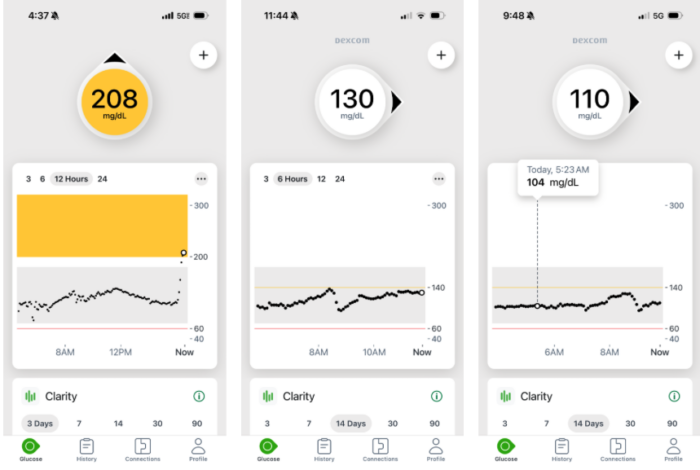 Sarah Hormachea: Diabetes Care and Education CGM Reports